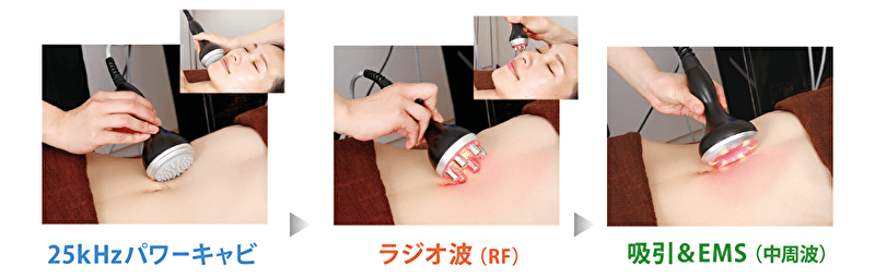 キャビリポ3step