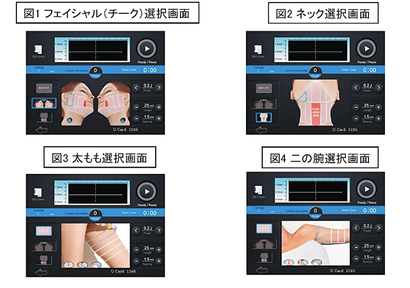 ウエルダンソニック_2